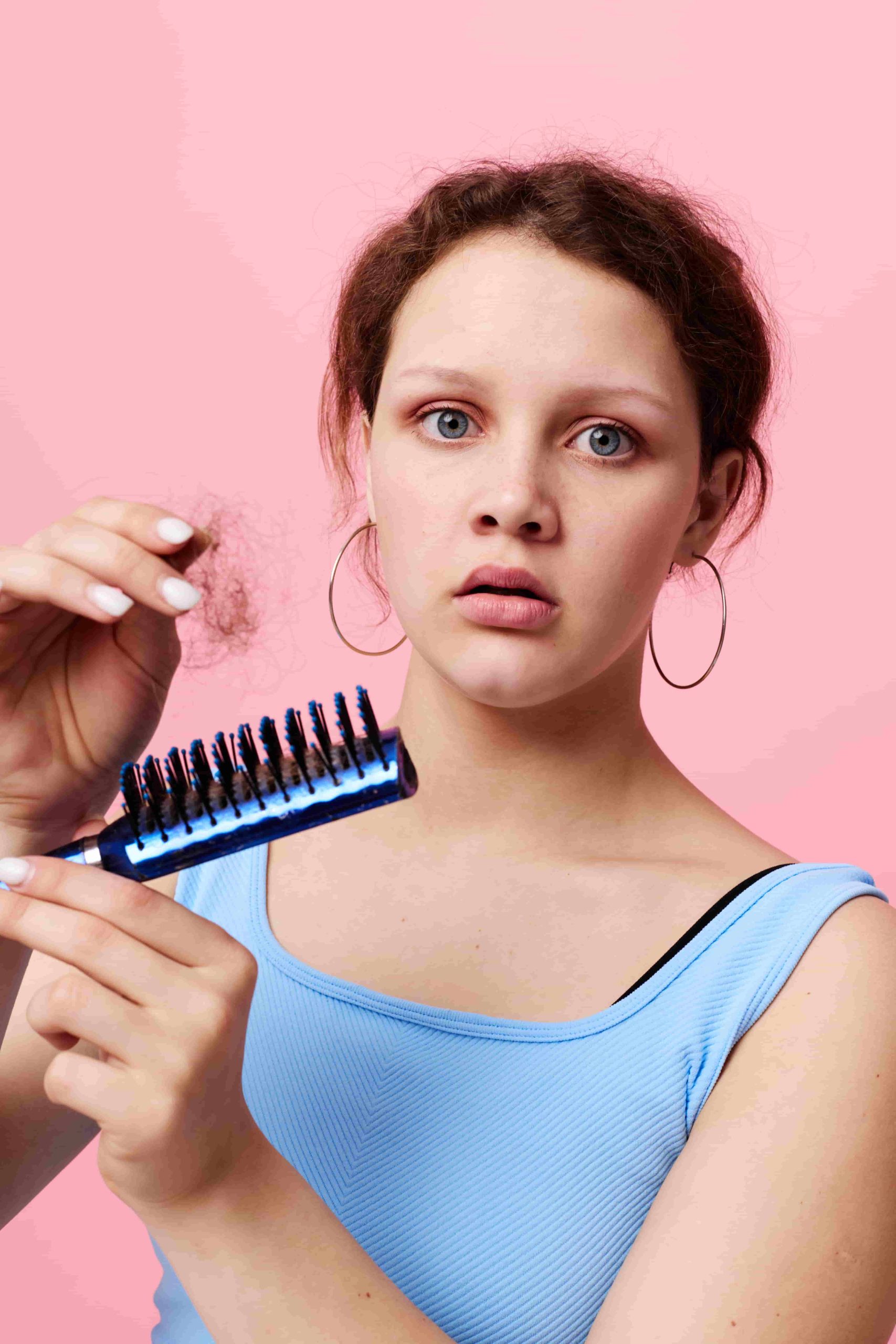 Hair loss Treatment in hyderabad