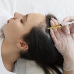 hair treatment in banjarahills - Dr Sudhavani